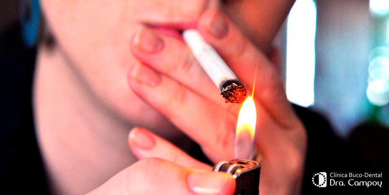 Tabaco y salud bucodental